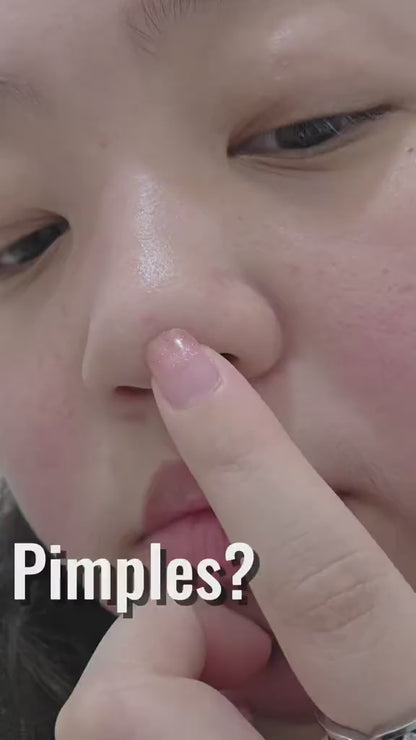 Combat Blemished Skin - Treat Pimples, Acne & Blemished Skin