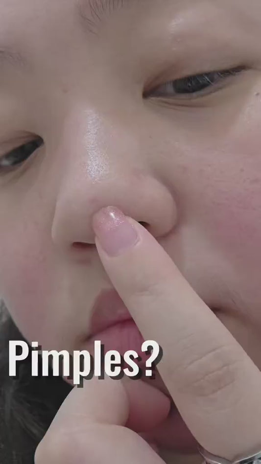 Combat Blemished Skin - Treat Pimples, Acne & Blemished Skin
